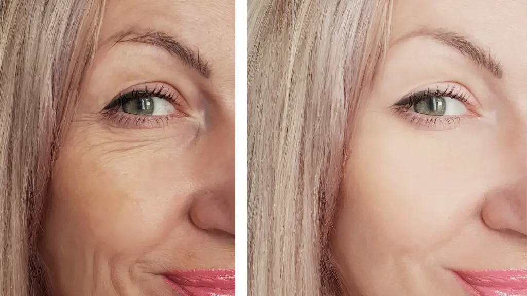 The Truth About Anti-Aging Skincare: What Works